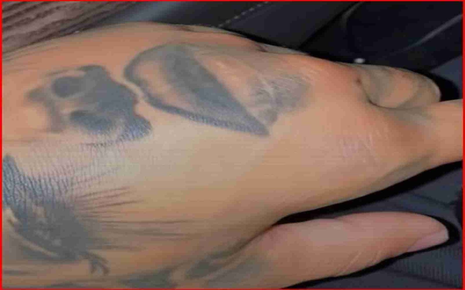 Watch: First Look At Gervonta Davis Hand Injury 6 Watch: First Look At Gervonta Davis Hand Injury