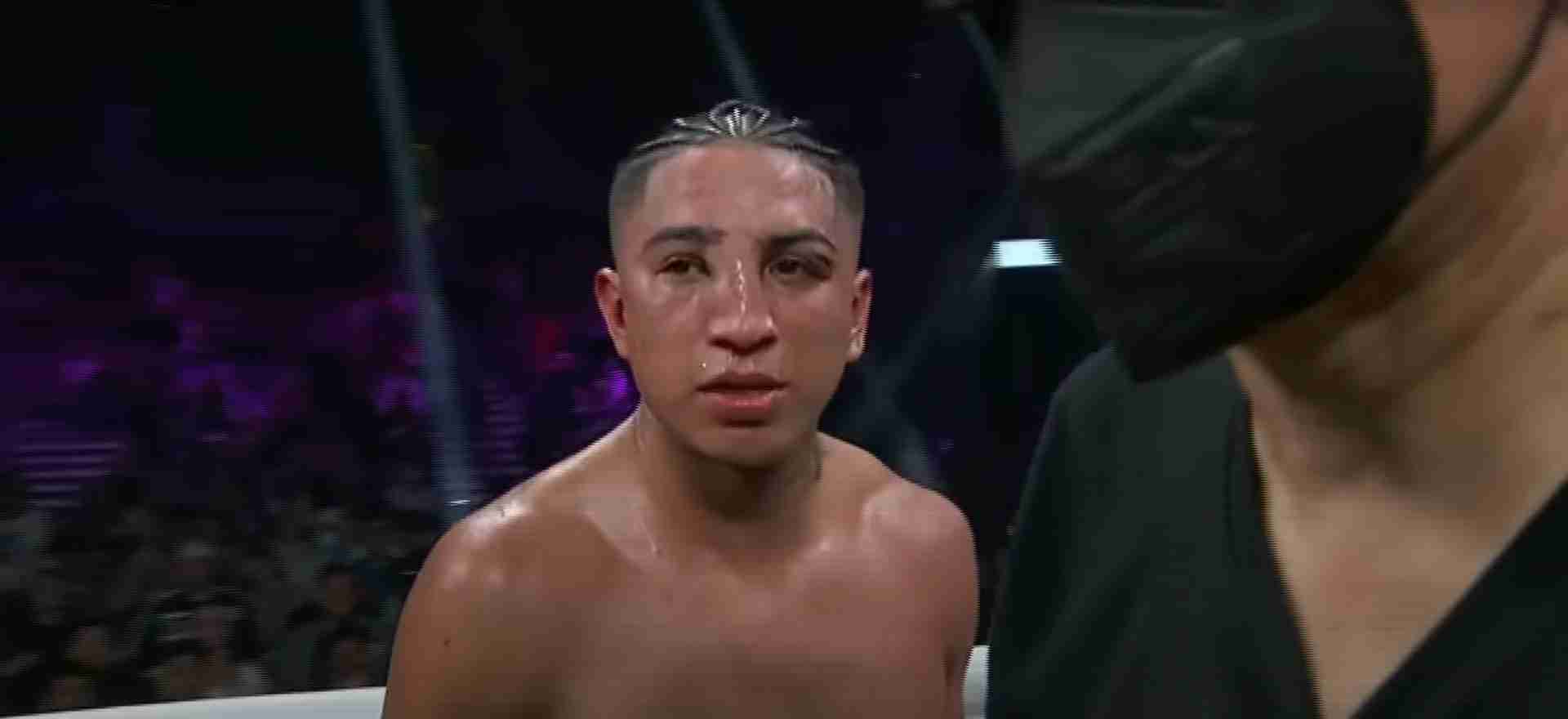 Keith Thurman Opponent Barrios Suffers Bad Broken Nose