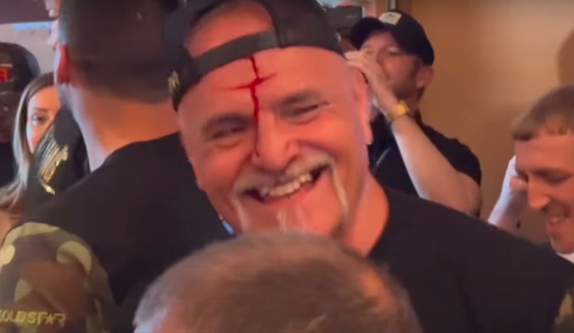 John Fury Reacts To Headbutting Usyk Team Member 2 John Fury reacts to headbutt