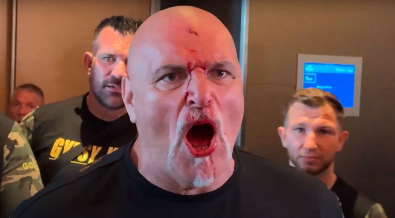 Tyson Fury Reacts To Father's Headbutt