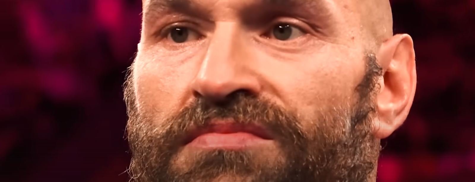 Tyson Fury Sparring Cut