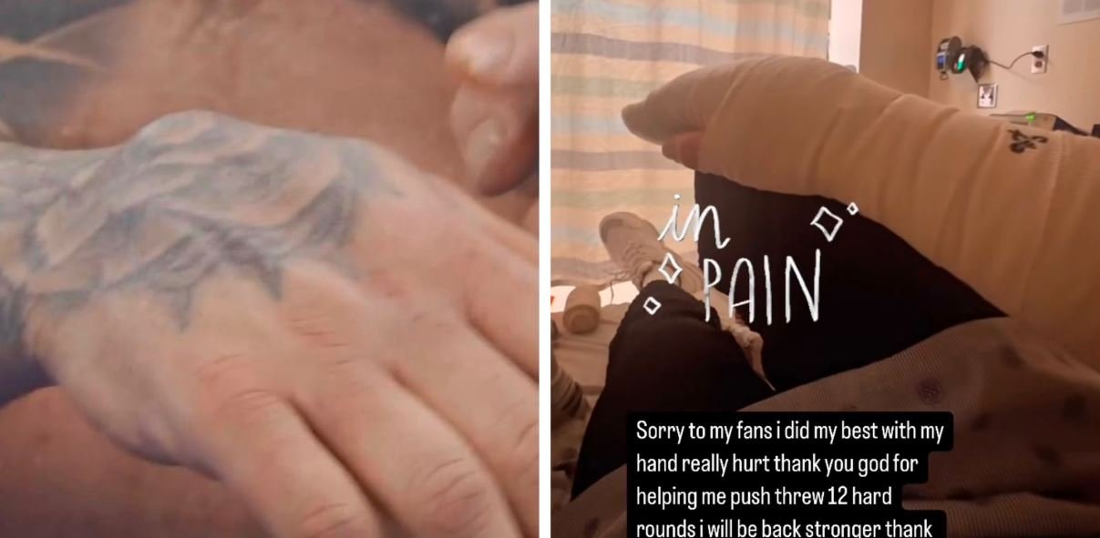 Andy Ruiz In Hospital With 1 Of Worst Broken Hands In Boxing History