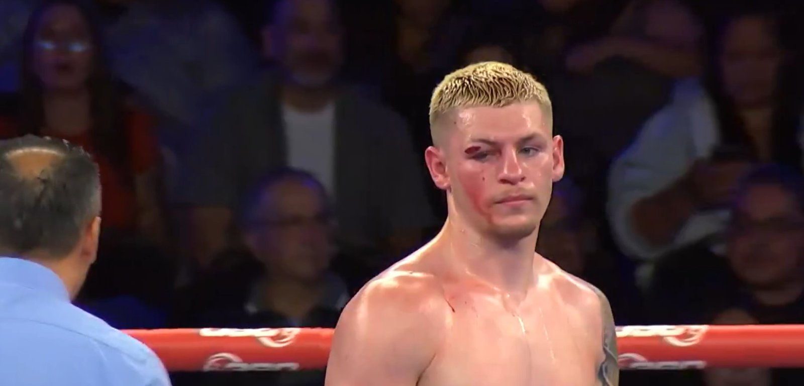 Doctor Stops Callum Walsh Fight Due To Brutal Cut Over Eye