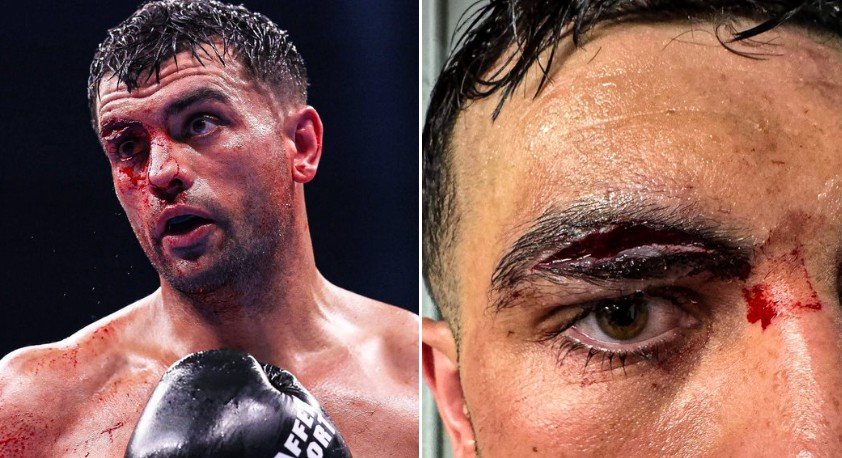 One Of The Worst Cuts In Boxing History