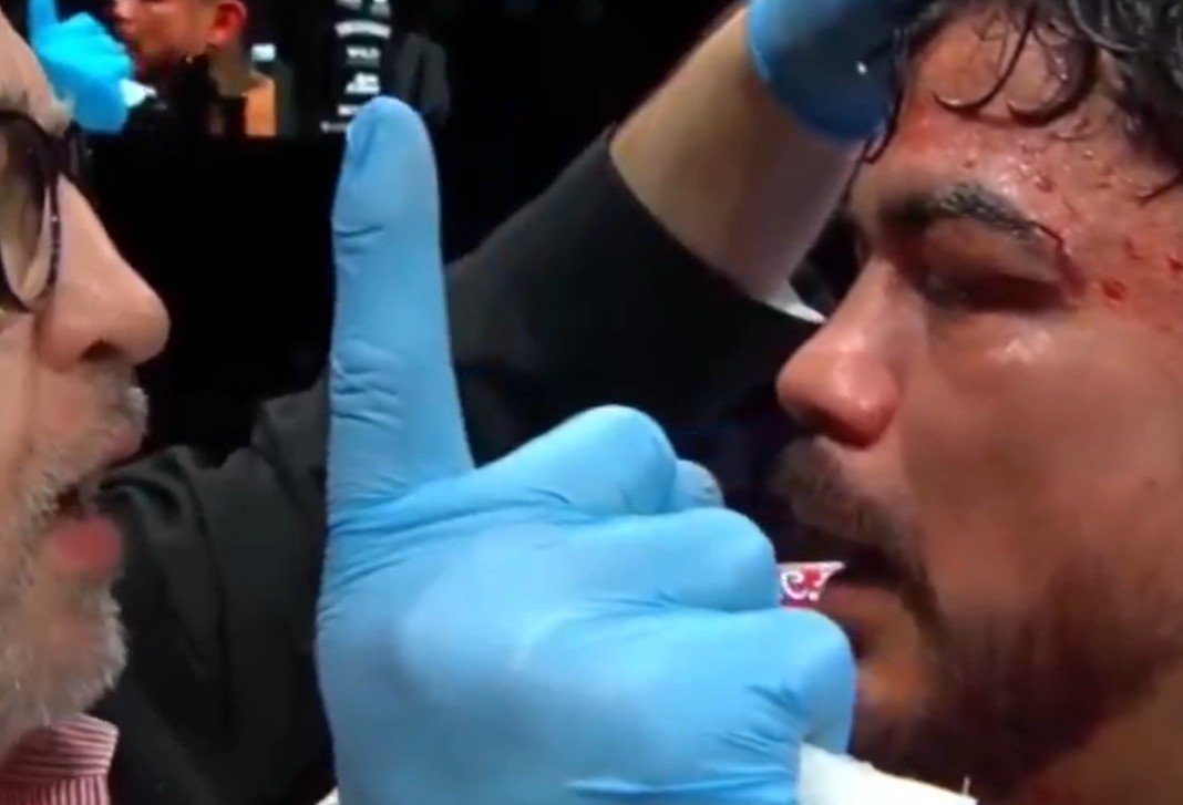 Jojo Diaz fails test with flying colors and is allowed to continue boxing
