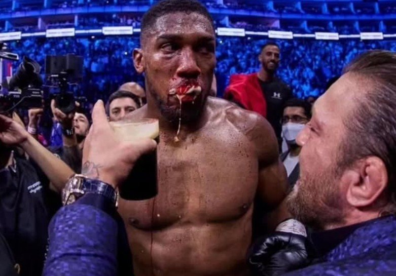 Conor McGregor Appears To Troll Anthony Joshua On Jake Paul Fight Day