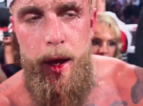 Watch: Jake Paul Broken Jaw After Joshua Knockout 2 Jake Paul Broken Jaw After Joshua Knockout