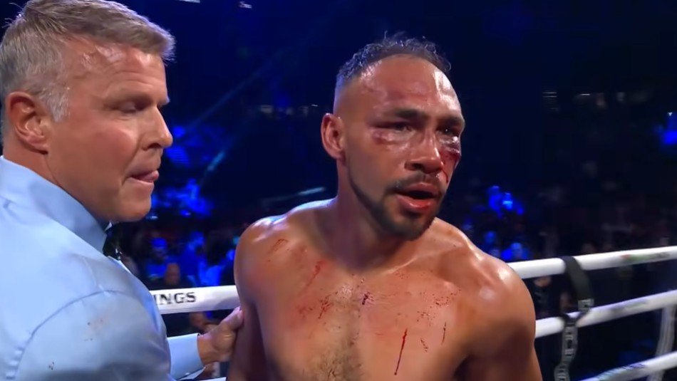 Boxing World React To Sebastian Fundora Ending Keith Thurman 2 Boxing World React To Sebastian Fundora Ending Keith Thurman