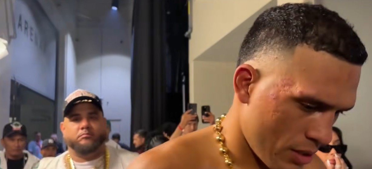 David Benavidez On Zurdo Power After Knocking Him Out