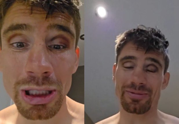 rico verhoeven