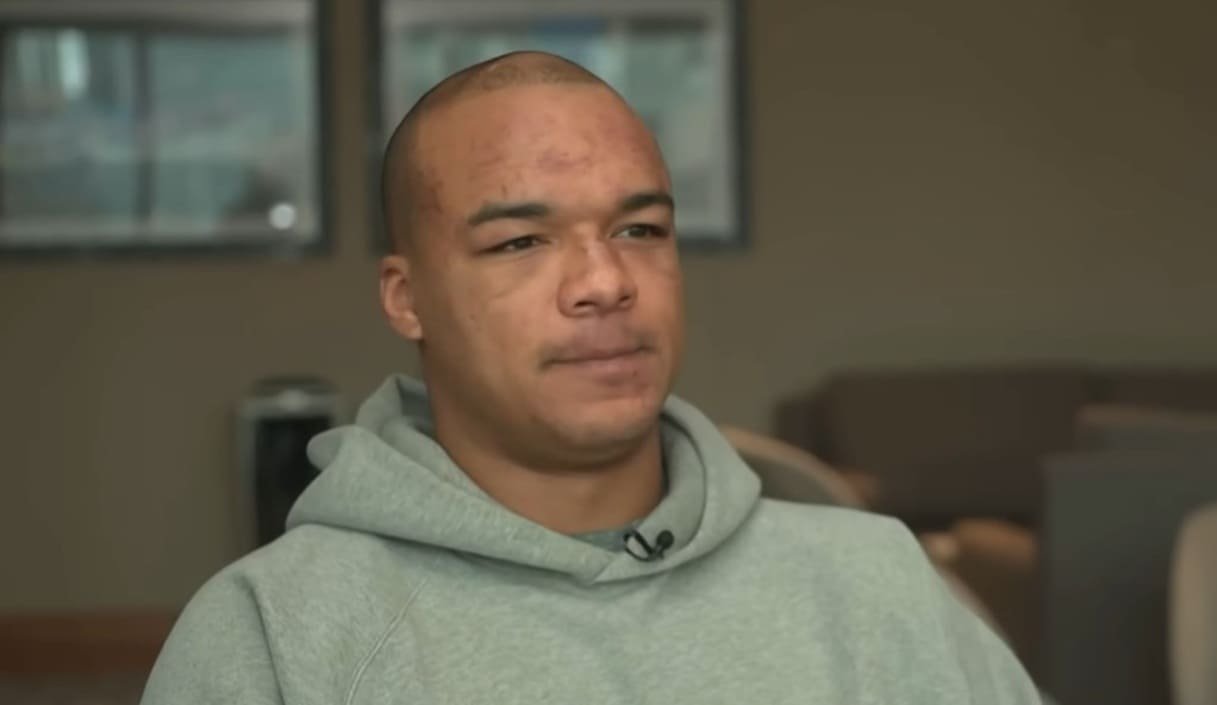 Fabio Wardley Estimated Repair Time From Dubois TKO Loss And Possible Comeback Opponents 1 Fabio Wardley Estimated Repair Time From Dubois TKO Loss And Possible Comeback Opponents