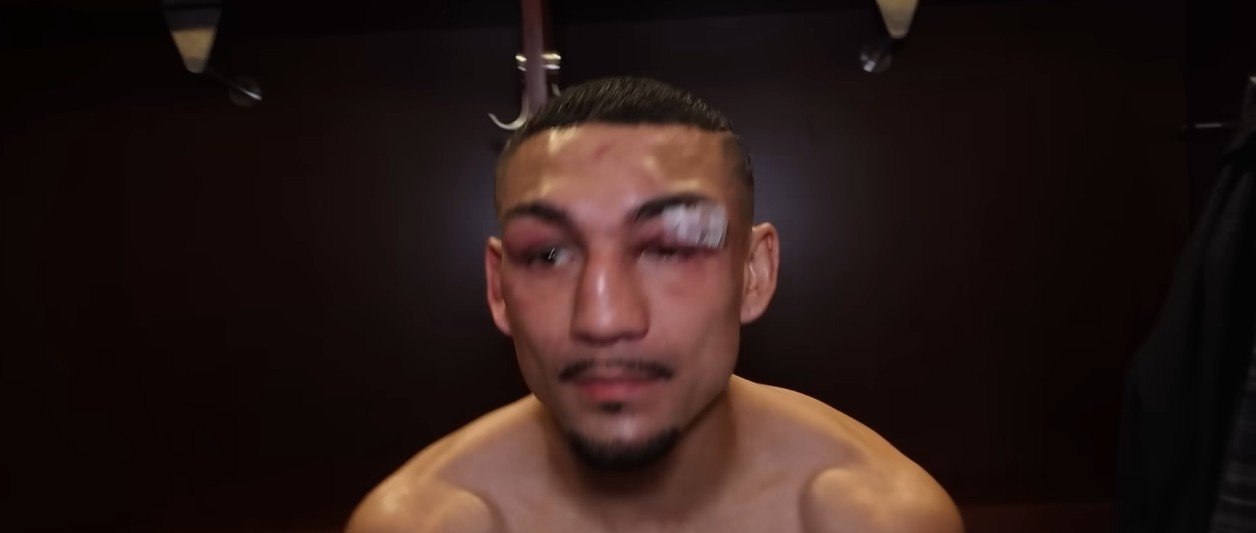 Blame Game Won't Help: Reasons Teofimo Lopez Can't Pin the Shakur Stevenson Loss on His Dad